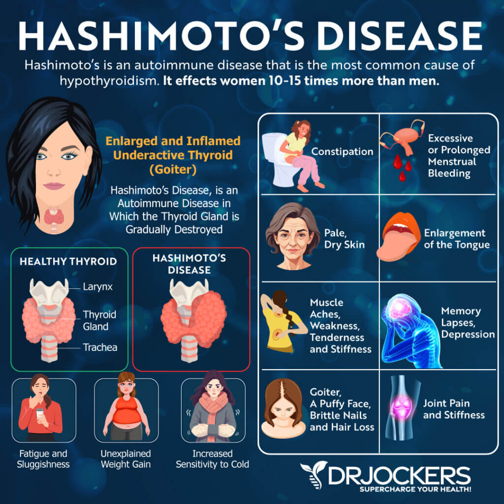 Diagnose Hashimoto’s